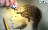 Απώλεια μνήμης Πότε είναι Αλτσχάιμερ και πότε απλή γήρανση Απώλεια μνήμης: Πότε είναι Αλτσχάιμερ και πότε απλή γήρανση