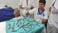 Γιατροί αφαίρεσαν 40 μαχαίρια από το στομάχι αστυνομικού! Γιατροί αφαίρεσαν 40 μαχαίρια από το στομάχι αστυνομικού!