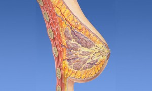 Καρκίνος του μαστού