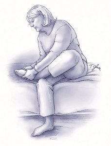 Διαβητικό πόδι