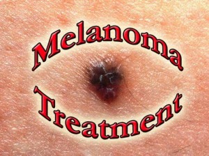 μελανώματος 