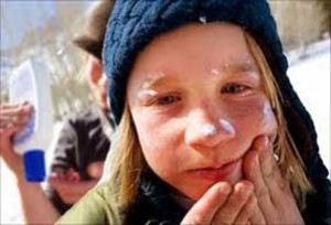 αντηλιακό και το χειμώνα