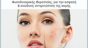 Μεγάλος διαγωνισμός με δωρεάν συνεδρίες φωτοδυναμικής θεραπείας