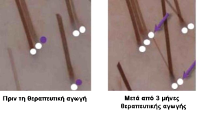 Μεγάλος Διαγωνισμός του Medlabnews.gr και του Iatrikanea.gr