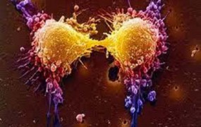 Μηχανισμός και παράγοντες που συμβάλλουν στις μεταστάσεις του καρκίνου; Πνευμονικές, ηπατικές, οστικές, εγκεφαλικές μεταστάσεις.