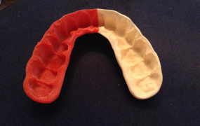 Πως προστατεύουν τα δόντια τους oσοι αθλούνται;