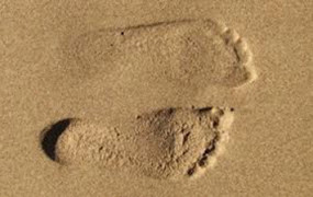 Πλατυποδία, για μικρούς και μεγάλους, αιτία για προβλήματα στο γόνατο και εκφυλιστική αρθροπάθεια.