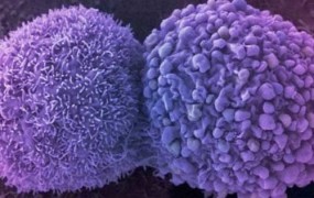 Νέες προοπτικές στη θεραπεία των ασθενών με προχωρημένο μελάνωμα στην Ευρώπη