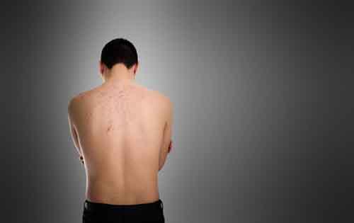 Ατοπική δερματίτιδα: Τι είναι, πού εμφανίζεται και ποια είναι τα συμπτώματα