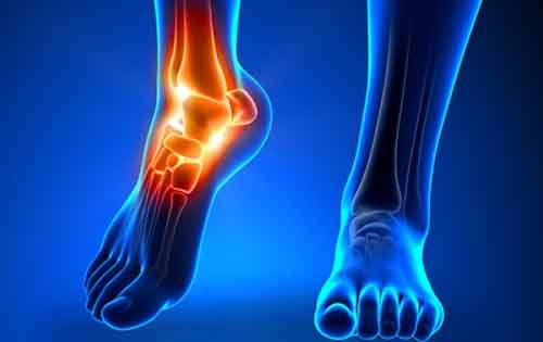 Ο χυμός που διαλύει το ουρικό οξύ στις αρθρώσεις