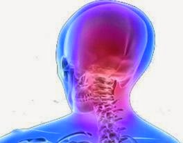 Αυχενογενής πονοκέφαλος. Πονοκέφαλος στην βάση του κρανίου. Αιτίες, Συμπτώματα και αντιμετώπιση