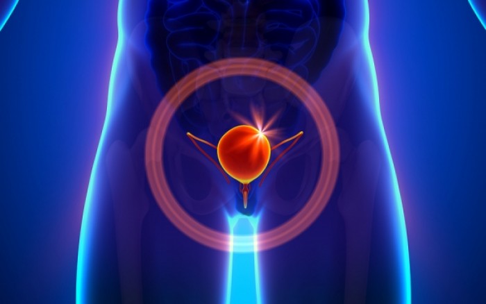 Κυστεοουρητηρική παλινδρόμηση: Βασική αιτία της συχνής ουρολοίμωξης
