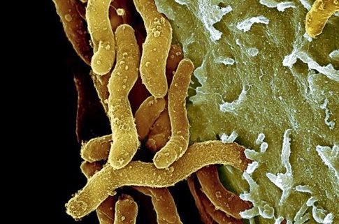 Πώς το Πάσχα βοήθησε να καταρριφθεί ο μύθος για το έλκος