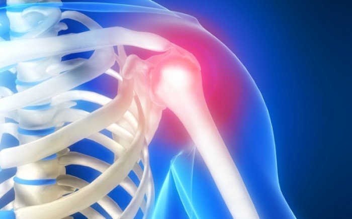 Τενοντίτιδα ώμου: Πώς εκδηλώνεται, πώς την αντιμετωπίζουμε