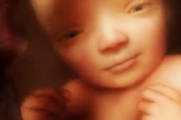 Αυξημένος ο κίνδυνος αυτισμού στα πρόωρα μωρά