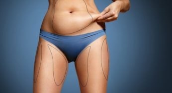 Βρείτε τι είδος λίπους έχετε στο σώμα σας!