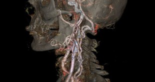 Το μέλλον της τομογραφίας, σε τρομακτικά υψηλή ανάλυση