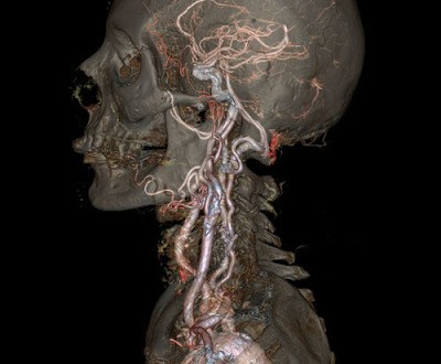 Το μέλλον της τομογραφίας, σε τρομακτικά υψηλή ανάλυση