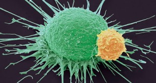 Η εμφάνιση του καρκίνου ανά ηλικία και φύλο. Επιδημιολογικά στοιχεία