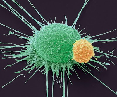 Η εμφάνιση του καρκίνου ανά ηλικία και φύλο. Επιδημιολογικά στοιχεία