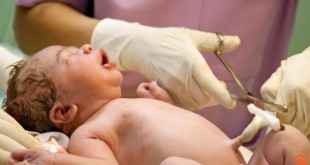 Να φυλάξετε βλαστοκύτταρα ή όχι;