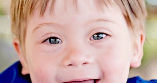 Σύνδρομο Down. Τι είναι και γιατί πρέπει να αρθεί η κοινωνική προκατάληψη (video)