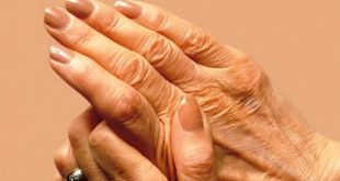 1 στους 4 υποφέρει από ρευματικές παθήσεις