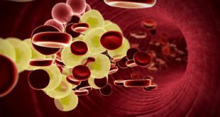 Θετικά αποτελέσματα φαρμάκου για την μείωση της LDL χοληστερίνης