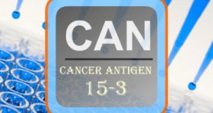 Ο καρκινικός δείκτης για τον καρκίνο του μαστού Ca 15-3. Πόσο σημαντικός είναι και τι σημαίνουν τα υψηλά επίπεδα;
