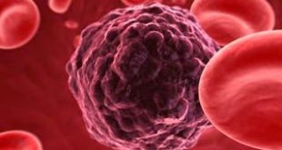 Αλλεργίες, συνάχι, αυτοάνοσα νοσήματα, αρθρίτιδες είναι ανοσολογικές αντιδράσεις. Παγκόσμια Ημέρα Ανοσολογίας