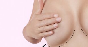 Καλοήθεις παθήσεις μαστού: Πότε προκαλούν ανησυχία