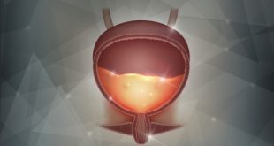 Ουρολοίμωξη: Τα 10 βασικά μέτρα πρόληψης