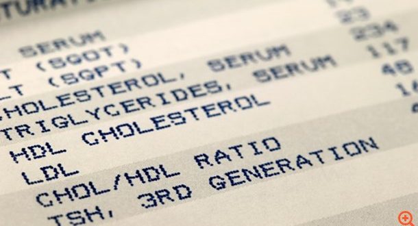 Το Πάσχα πέρασε. Ώρα να τσεκάρετε τη χοληστερίνη σας