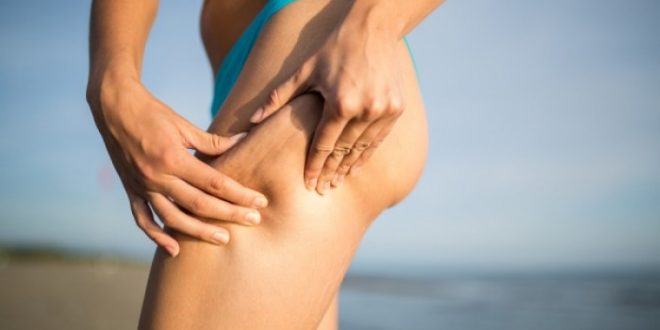 Διατροφικές και άλλες συμβουλές για την κυτταρίτιδα