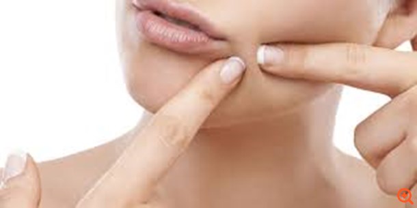 10 πράγματα που δεν πρέπει να κάνετε αν έχετε σπυράκια