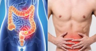 Ο καρκίνος του παχέος εντέρου, ποιους προσβάλλει, πώς γίνεται η διάγνωση και ποια η σωστή διατροφή;