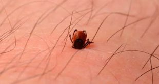 Ενοχλητικά έντομα - Επώδυνα τσιμπήματα