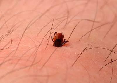 Ενοχλητικά έντομα - Επώδυνα τσιμπήματα