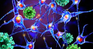 Ελπίδες για την καθυστέρηση της εξέλιξης της αναπηρίας στην Πολλαπλή Σκλήρυνση