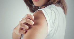 Έκζεμα ενηλίκων: 5 παράγοντες κινδύνου που πρέπει να γνωρίζετε