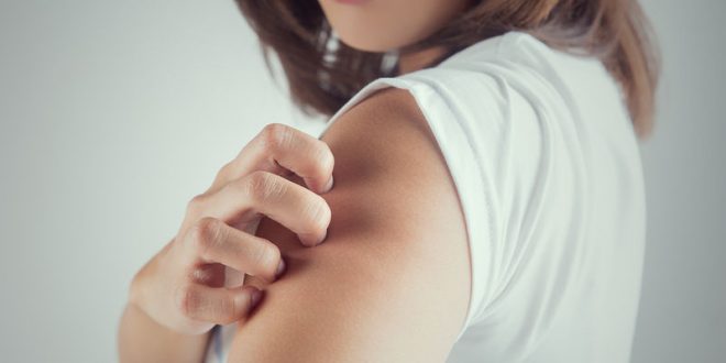 Έκζεμα ενηλίκων: 5 παράγοντες κινδύνου που πρέπει να γνωρίζετε