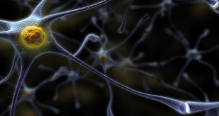 Πρωτοποριακή υπολογιστική μεθοδολογία για τη μελέτη νευροεκφυλιστικών νόσων