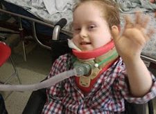 Πρωτοποριακή χειρουργική επέμβαση διόρθωσε παράλυση σε εξάχρονο κοριτσάκι