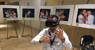 Χρόνια Αυθόρμητη Κνίδωση και η έκθεση φωτογραφίας «Αποκαλύψτε το Δέρμα σας»