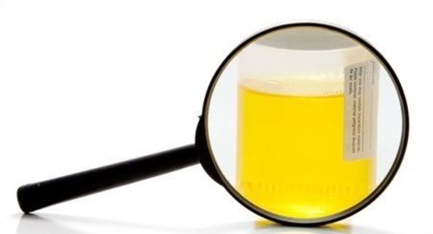 Τι αποκαλύπτει το χρώμα των ούρων για την υγεία σας;