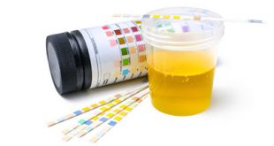 Ποια η προετοιμασία για τη σωστή λήψη και αποστολή των ούρων για μικροβιολογική εξέταση και καλλιέργεια;