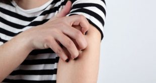 Έκζεμα: Πώς θα κλείσετε τον κύκλο της φαγούρας