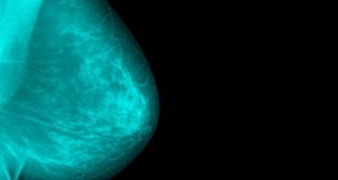 Καρκίνος του μαστού: Ο ρόλος των αποβολών