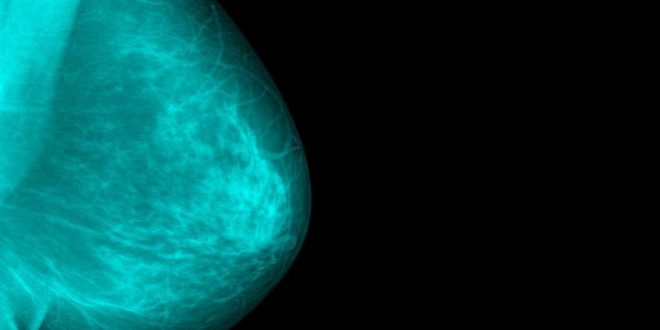 Καρκίνος του μαστού: Ο ρόλος των αποβολών