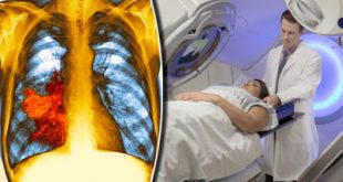 Μεγάλες ελπίδες για τους ασθενείς με καρκίνο του πνεύμονα νέου θεραπευτικού συνδυασμού